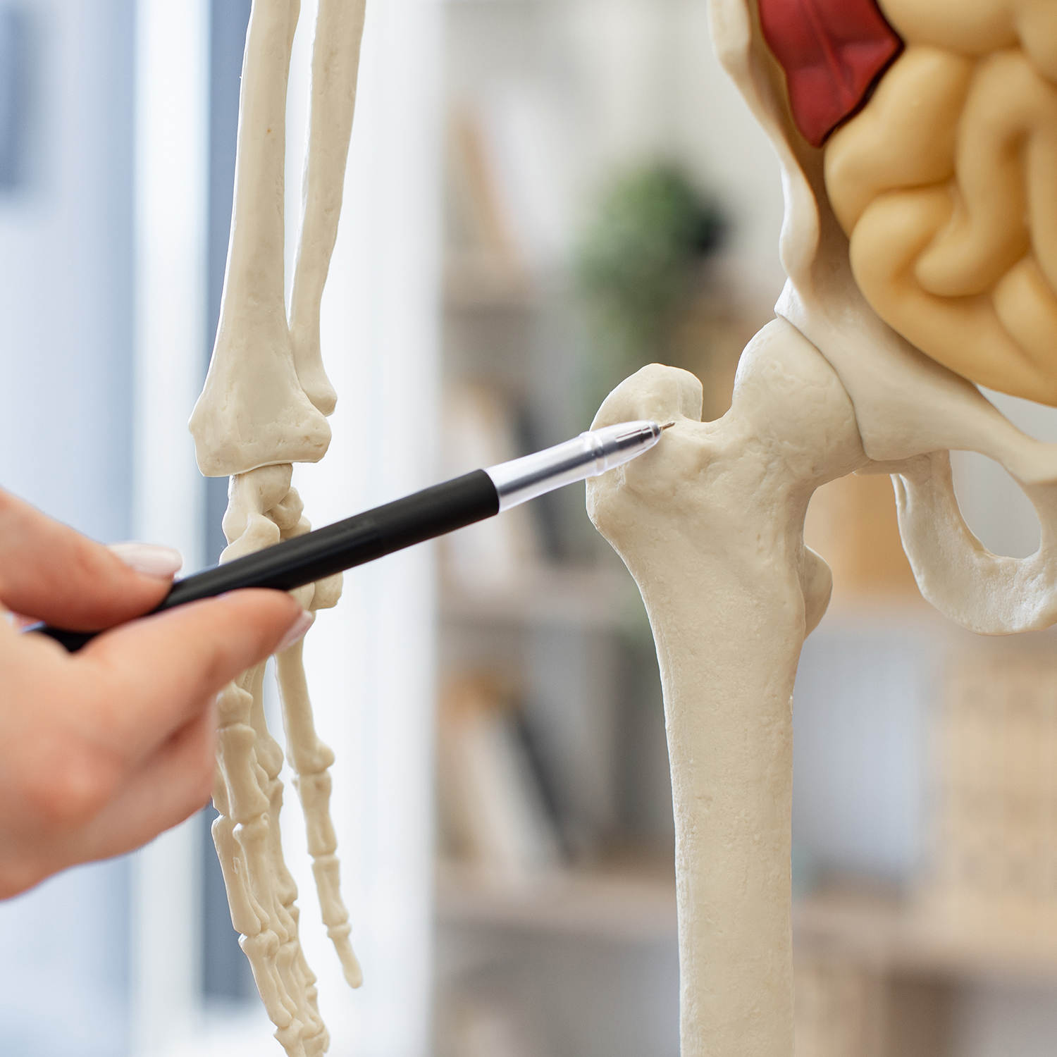 Osteotomía